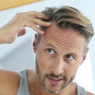Hair Loss treatment in Islamabad Pakistan