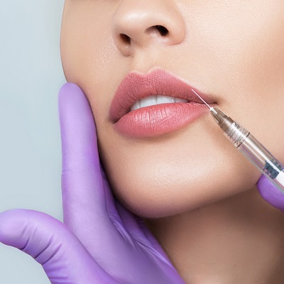 Lip fillers in islamabad Pakistan